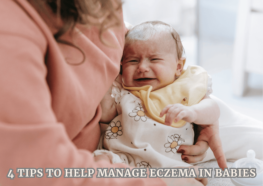 4 Tips to Help Manage Eczema in Babies - Proactive Baby
