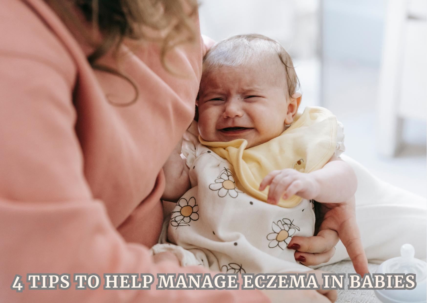4 Tips to Help Manage Eczema in Babies