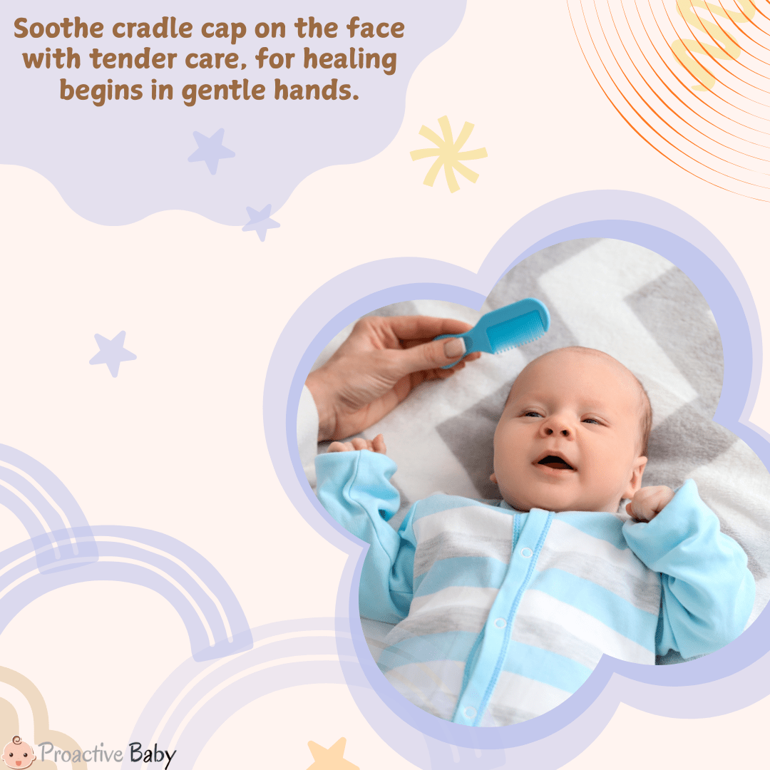 How To Treat Cradle Cap on Face? - Proactive Baby