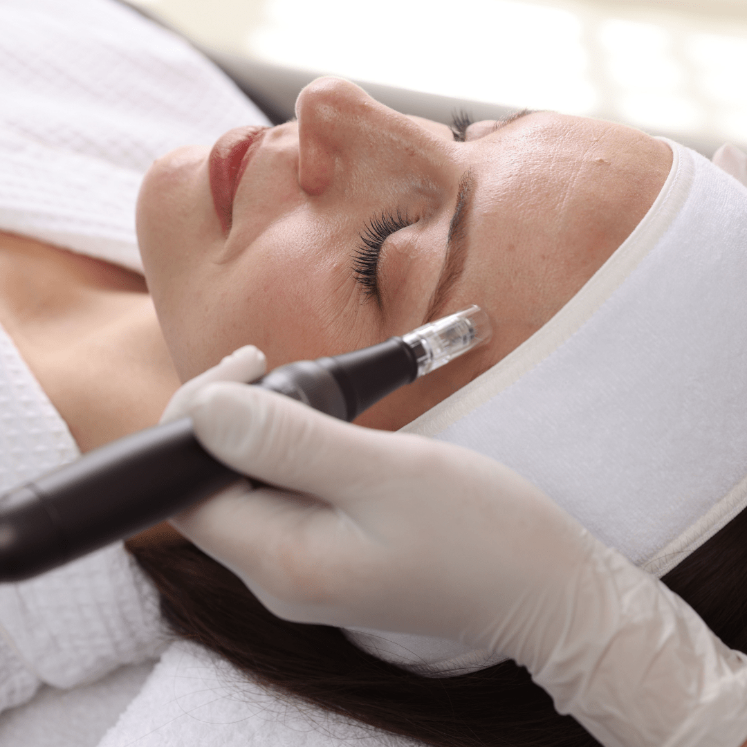 RF Microneedling vs. Traditional Microneedling: What’s the Difference and Which Is Right for You? - Proactive Baby